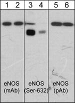 Phospho-eNOS (Ser632) Monoclonal Antibody (M232)