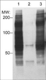 Phosphotyrosine Antibody in Western Blot (WB)