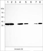 Annexin A2 Monoclonal Antibody (M009)