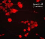 Annexin A2 Monoclonal Antibody (M298)