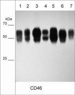 CD46 Antibody in Western Blot (WB)