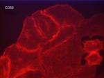 CD59 Monoclonal Antibody (M015)