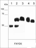 Dysadherin Monoclonal Antibody (M029)