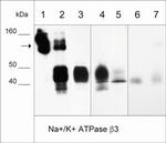 CD298 Antibody in Western Blot (WB)