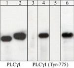 PLCG1 Antibody in Western Blot (WB)