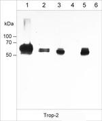 TROP2 Monoclonal Antibody (M005)