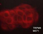 TRPM8 Monoclonal Antibody (M571)