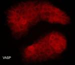 VASP Monoclonal Antibody (M277)