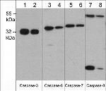 Caspase 6 Monoclonal Antibody (M378)