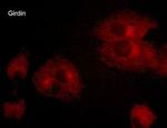 Girdin Monoclonal Antibody (M012)