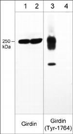 Girdin Antibody in Western Blot (WB)