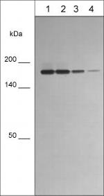 CD11a Antibody in Western Blot (WB)