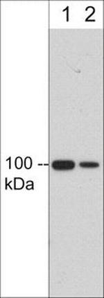 CD61 (Integrin beta 3) Monoclonal Antibody (M581)