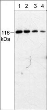 PYK2 Monoclonal Antibody (M229)