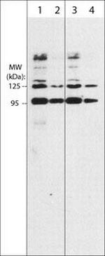 SEMA3A Monoclonal Antibody (M317)