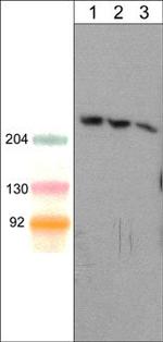 SHANK1 Monoclonal Antibody (M369)