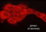 SPHK1 Monoclonal Antibody (M540)