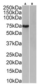 6x His Tag Chimeric Antibody in Western Blot (WB)