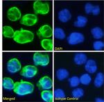Muromonab Chimeric Recombinant Rabbit Monoclonal Antibody (OKT-3 (muromonab))