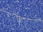 CD52 Chimeric Antibody in Immunohistochemistry (Paraffin) (IHC (P))