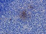 CD52 Chimeric Antibody in Immunohistochemistry (Paraffin) (IHC (P))