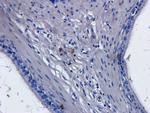CD52 Chimeric Antibody in Immunohistochemistry (Paraffin) (IHC (P))