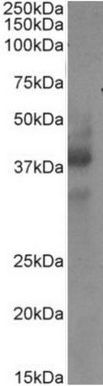 CD34 Chimeric Antibody in Western Blot (WB)