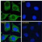 CD299 (DC-SIGN/L) Chimeric Recombinant Rabbit Monoclonal Antibody (16E7)
