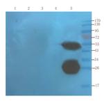 Infliximab Chimeric Antibody in Western Blot (WB)
