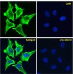 AOC3 Chimeric Recombinant Rabbit Monoclonal Antibody (2D10)