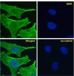 NOTCH2 Chimeric Antibody in Immunocytochemistry (ICC/IF)