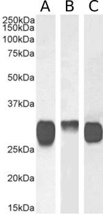 HLA-DR/DP/DQ Chimeric Recombinant Rabbit Monoclonal Antibody (F3.3)
