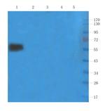 Basiliximab Chimeric Antibody in Western Blot (WB)