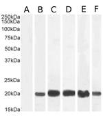 IL-2 Chimeric Antibody in Western Blot (WB)