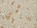 Polysialic acid Chimeric Antibody in Immunohistochemistry (PFA fixed) (IHC (PFA))