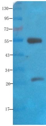 Polysialic acid Chimeric Antibody in Western Blot (WB)