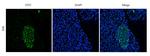 CD66e (CEACAM5) (Arcitumomab Biosimilar) Recombinant Human Monoclonal Antibody (Arcitumomab)