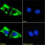 ErbB2 (HER-2) Recombinant Rabbit Monoclonal Antibody (SAIC-02A-7)