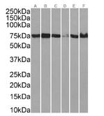 XPNPEP1 Antibody in Western Blot (WB)