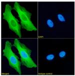 HSP27 Recombinant Rabbit Monoclonal Antibody (SAIC-23C-35)