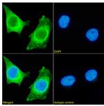 HSP27 Recombinant Rabbit Monoclonal Antibody (SAIC-23E-30)