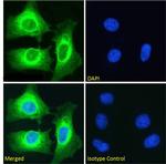 NFkB p100 Recombinant Rabbit Monoclonal Antibody (SAIC-26C-15)