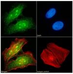 RAD23B Antibody in Immunocytochemistry (ICC/IF)