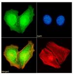 RAD23B Recombinant Rabbit Monoclonal Antibody (SAIC-28B-8)