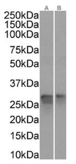 PRDX4 Antibody in Western Blot (WB)