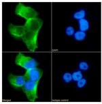 SERPINA6 Recombinant Rabbit Monoclonal Antibody (SAIC-42B-10)