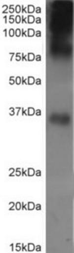 Rhodopsin Antibody in Western Blot (WB)