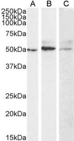 MMP14 Antibody in Western Blot (WB)