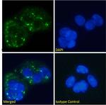 Glucagon Receptor Recombinant Mouse Monoclonal Antibody (hGR-2 F6)