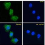 GIPR Chimeric Recombinant Rabbit Monoclonal Antibody (Gipg013)
